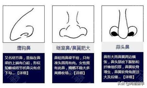 面相分析鼻子|鼻相分析10款｜鼻樑有節及橫紋、豬膽鼻、鼻頭下垂代表甚麼？姻 